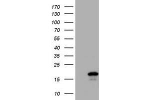 Image no. 1 for anti-Cystatin SA (CST2) antibody (ABIN1497761) (CST2 Antikörper)
