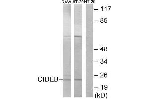 Western Blotting (WB) image for anti-Cell Death-Inducing DFFA-Like Effector B (CIDEB) (Internal Region) antibody (ABIN1850417) (CIDEB Antikörper  (Internal Region))