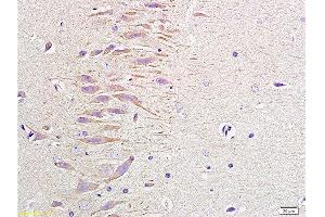Formalin-fixed and paraffin embedded rat brain labeled with Anti-NPY/Neuropeptide Y Polyclonal Antibody, Unconjugated 1:400 followed by conjugation to the secondary antibody and DAB staining (NPY Antikörper  (AA 29-64))