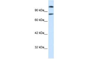 WB Suggested Anti-SREBF2 Antibody Titration:  0. (SREBF2 Antikörper  (Middle Region))