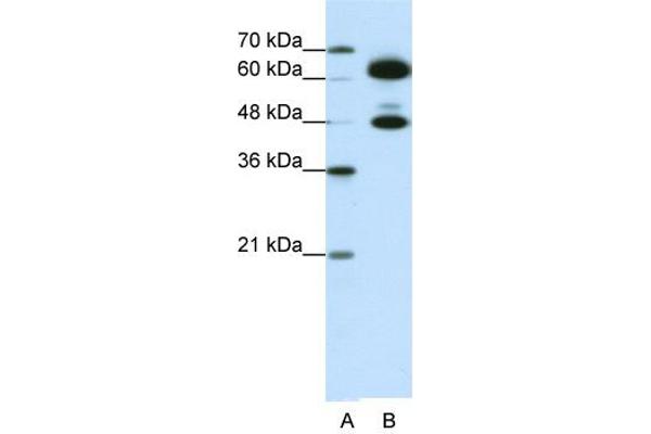 SNRNP70 Antikörper  (C-Term)