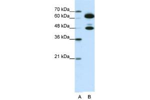 WB Suggested Anti-SNRP70 Antibody Titration:  0. (SNRNP70 Antikörper  (C-Term))