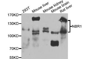 Western blot analysis of extracts of various cell lines, using NBR1 antibody (ABIN1873830) at 1:1000 dilution.