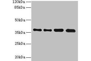 Western blot All lanes: TMEM19 antibody at 1 μg/mL Lane 1: MCF-7 whole cell lysate Lane 2: U251 whole cell lysate Lane 3: Mouse stomach tissue Lane 4: A549 whole cell lysate Secondary Goat polyclonal to rabbit IgG at 1/10000 dilution Predicted band size: 37, 33 kDa Observed band size: 37 kDa (TMEM19 Antikörper  (AA 105-217))