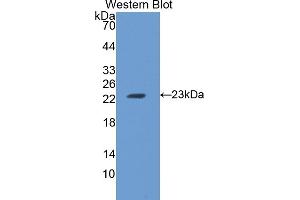 Detection of Recombinant FTH, Rat using Polyclonal Antibody to Ferritin, Heavy Polypeptide (FTH) (FTH1 Antikörper)