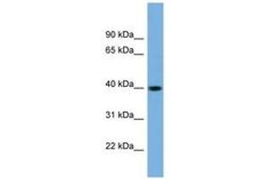 Image no. 1 for anti-SUMO1 Activating Enzyme Subunit 1 (SAE1) (N-Term) antibody (ABIN6743621) (SAE1 Antikörper  (N-Term))