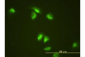 Immunofluorescence of monoclonal antibody to SLBP on HeLa cell.