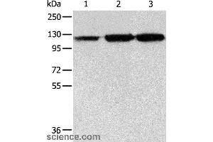 Western blot analysis of PC3 cell, human colon cancer and liver cancer tissue, using HSPH1 Polyclonal Antibody at dilution of 1:500 (HSPH1 Antikörper)