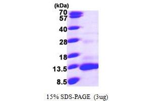 Chemokine (C-C Motif) Ligand 13 (CCL13) (AA 24-98) protein (His tag)