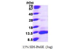 SDS-PAGE (SDS) image for Chemokine (C-C Motif) Ligand 13 (CCL13) (AA 24-98) protein (His tag) (ABIN6386599) (CCL13 Protein (AA 24-98) (His tag))