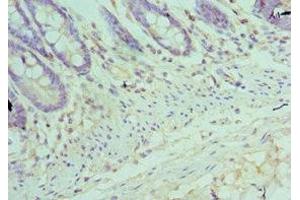 Immunohistochemistry of paraffin-embedded human colon tissue using ABIN7172504 at dilution of 1:100 (DP1 Antikörper  (AA 1-290))