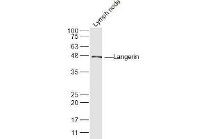 Mouse Lymph node lysates probed with Langerin Polyclonal Antibody, Unconjugated  at 1:300 dilution and 4˚C overnight incubation. (CD207 Antikörper  (AA 161-260))