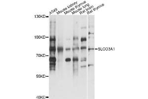 Western blot analysis of extracts of various cell lines, using SLCO3A1 antibody (ABIN6293704) at 1:3000 dilution. (Solute Carrier Organic Anion Transporter Family, Member 3A1 (SLCO3A1) Antikörper)