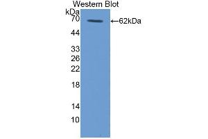 Western blot analysis of recombinant Human TPO. (Thrombopoietin Antikörper  (AA 25-298))