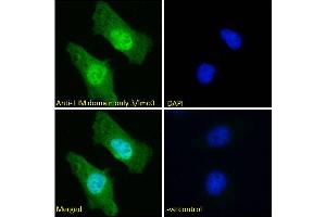 ABIN6391400 Immunofluorescence analysis of paraformaldehyde fixed HeLa cells, permeabilized with 0.