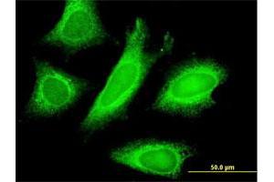 Immunofluorescence of monoclonal antibody to STAU1 on HeLa cell. (STAU1/Staufen Antikörper  (AA 401-496))