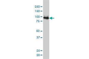 UBE3A monoclonal antibody (M01), clone 2F6 Western Blot analysis of UBE3A expression in Jurkat (ABIN1339540). (ube3a Antikörper  (AA 51-150))