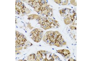 Immunohistochemistry of paraffin-embedded human stomach using CHIC2 antibody (ABIN5974773) at dilution of 1/100 (40x lens). (CHIC2 Antikörper)