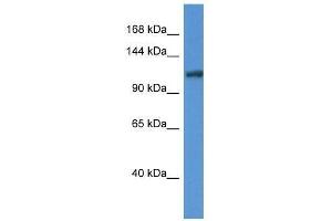 Western Blot showing Ano6 antibody used at a concentration of 1. (Anoctamin 6 Antikörper  (Middle Region))