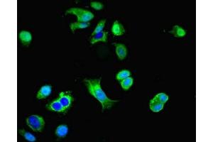 Immunofluorescent analysis of MCF-7 cells using ABIN7149644 at dilution of 1:100 and Alexa Fluor 488-congugated AffiniPure Goat Anti-Rabbit IgG(H+L) (GRID2IP Antikörper  (AA 35-156))