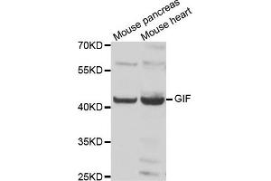 Western blot analysis of extracts of various cell lines, using GIF antibody. (Intrinsic Factor Antikörper)