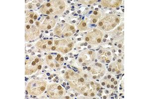 Immunohistochemistry of paraffin-embedded mouse kidney using ID3 antibody at dilution of 1:200 (400x lens). (ID3 Antikörper)