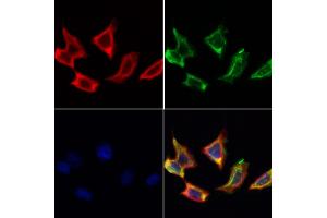 ABIN6259603 and ABIN6274618 staining Hela cells by IF/ICC. (CDKAL1 Antikörper  (N-Term))