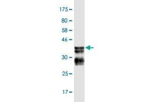 Western Blot detection against Immunogen (36. (BCL9 Antikörper  (AA 1036-1135))