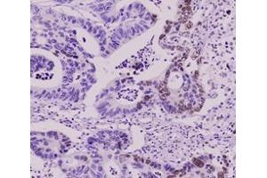 Immunohistochemistry (IHC) image for anti-Small Ubiquitin Related Modifier 2 (SUMO2) (AA 1-93), (N-Term) antibody (ABIN492386) (SUMO2 Antikörper  (N-Term))