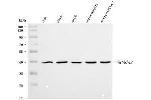 Western blot analysis of SPACA3 using anti-SPACA3 antibody (ABIN7602569).