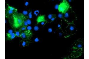 Anti-PDLIM2 mouse monoclonal antibody (ABIN2454449) immunofluorescent staining of COS7 cells transiently transfected by pCMV6-ENTRY PDLIM2 (RC210022). (PDLIM2 Antikörper)