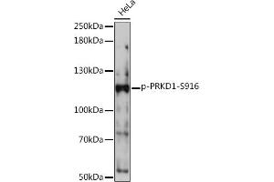 Western blot analysis of extracts of HeLa cells, using Phospho-PKC mu-S916 Rabbit pAb (ABIN7269642) at 1:1000 dilution. (PKC mu Antikörper  (pSer916))