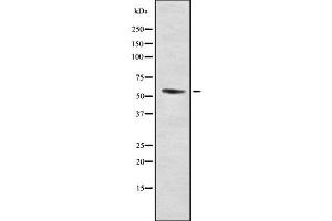 Western blot analysis of RMP using LOVO whole cell lysates (URI1 Antikörper  (Internal Region))