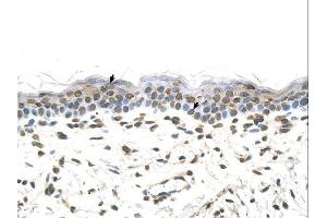 FTCD antibody was used for immunohistochemistry at a concentration of 4-8 ug/ml. (FTCD Antikörper  (Middle Region))