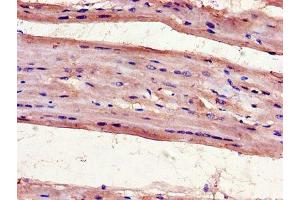 Immunohistochemistry of paraffin-embedded human heart tissue using ABIN7175097 at dilution of 1:100 (UNG Antikörper  (AA 114-224))