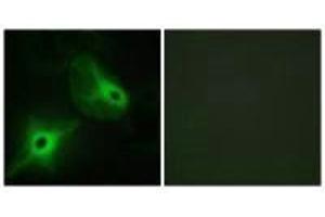 Immunofluorescence analysis of HeLa cells, using KSR2 antibody. (KSR2 Antikörper)