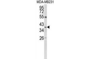 Western Blotting (WB) image for anti-Arginase, Liver (ARG1) antibody (ABIN5024445) (Liver Arginase Antikörper)