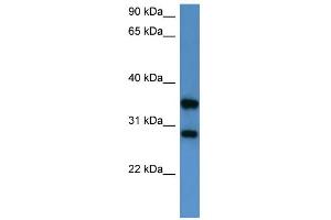WB Suggested Anti-STYXL1 Antibody Titration: 0. (STYXL1 Antikörper  (Middle Region))