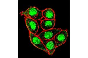 Confocal immunofluorescent analysis of Phospho-MUC1- Antibody (ABIN650864 and ABIN2839814) with Hela cell followed by Alexa Fluor 488-conjugated goat anti-rabbit lgG (green). (MUC1 Antikörper  (pThr1224))