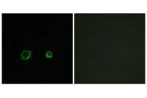 Immunofluorescence analysis of A549 cells, using CNTN4 antibody. (Contactin 4 Antikörper)
