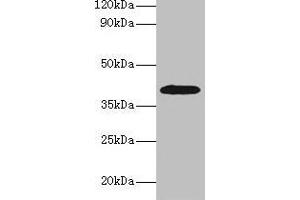 Western blot All lanes: ADH1B antibody at 2 μg/mL + HepG2 whole cell lysate Secondary Goat polyclonal to rabbit IgG at 1/15000 dilution Predicted band size: 40, 36 kDa Observed band size: 40 kDa (ADH1B Antikörper  (AA 2-375))