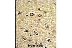 Immunohistochemistry (Paraffin-embedded Sections) (IHC (p)) image for anti-Growth Arrest-Specific 7 (GAS7) (AA 438-465), (C-Term) antibody (ABIN390589)