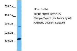 Host: Rabbit Target Name: SPRR1A Sample Tissue: Human Liver Tumor Antibody Dilution: 1ug/ml (SPRR1A Antikörper  (Middle Region))