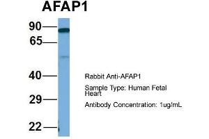 Host: Rabbit  Target Name: AFAP1  Sample Tissue: Human Fetal Heart  Antibody Dilution: 1.