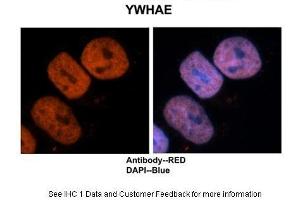 Sample Type :  Human brain stem cells  Primary Antibody Dilution :  1:500  Secondary Antibody :  Goat anti-rabbit Alexa-Fluor 594  Secondary Antibody Dilution :  1:1000  Color/Signal Descriptions :  Ywhae: Red DAPI:Blue  Gene Name :  Ywhae  Submitted by :  Dr. (YWHAE Antikörper  (C-Term))