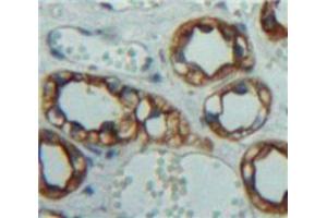 Used in DAB staining on fromalin fixed paraffin-embedded Kidney tissue (IL-10RA Antikörper  (AA 17-241))