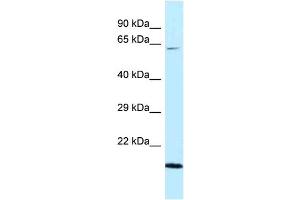 WB Suggested Anti-DNAJC11 Antibody Titration: 1. (DNAJC11 Antikörper  (C-Term))