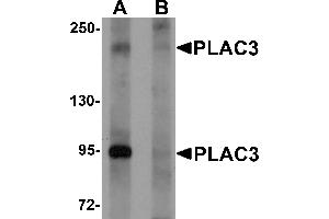 Western Blotting (WB) image for anti-Pappalysin 2 (PAPPA2) (N-Term) antibody (ABIN1031518) (PAPPA2 Antikörper  (N-Term))