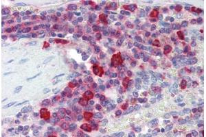 Human Spleen (formalin-fixed, paraffin-embedded) stained with PIM3 antibody ABIN462148 followed by biotinylated goat anti-rabbit IgG secondary antibody ABIN481713, alkaline phosphatase-streptavidin and chromogen. (PIM3 Antikörper  (AA 259-288))