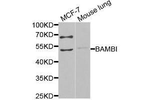 Western blot analysis of extracts of various cell lines, using BAMBI antibody (ABIN6291816) at 1:1000 dilution. (BAMBI Antikörper)